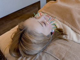 鍼灸整骨MIYABI 美容鍼のメニュー画像