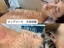 鍼処SHIRAKAWA京都院 (ルート治療専門院) ルート治療 60分 ロングコースのメニュー画像