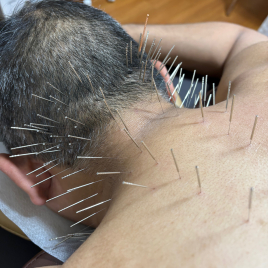 北京堂中目黒(くぎぬき鍼灸院) 肩こりのメニュー画像