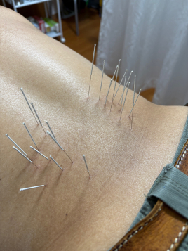 北京堂中目黒(くぎぬき鍼灸院) 腰痛のメニュー画像