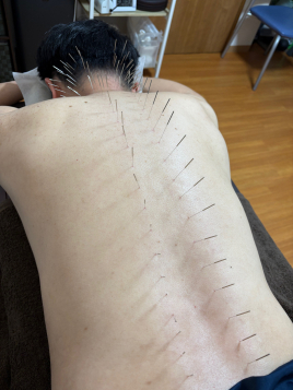 北京堂中目黒(くぎぬき鍼灸院) 自律神経のメニュー画像