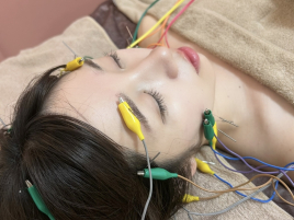 鍼灸マッサージサロンLa fonte 電気を流す美容鍼のメニュー画像