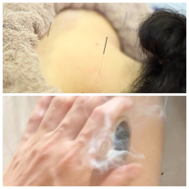 ひと香堂 はり灸 全身はり灸＋竹の輪灸de温活コリ流しのメニュー画像