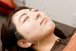 山王はりきゅうマッサージ処 りゅうしん堂 【オプション】美容鍼(通電あり)追加のメニュー画像