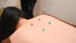 SCAPULAあざみ野荏田店 【初回】鍼灸整体治療のメニュー画像