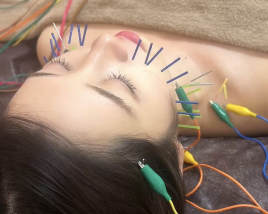 鍼灸マッサージサロンLa fonte ツヤ肌リフトアップ美容鍼のメニュー画像