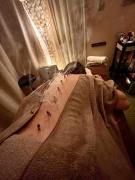 IKOSHI東西鍼灸院・東西漢方院 中医鍼灸コース（2回目以降）電話予約制のメニュー画像