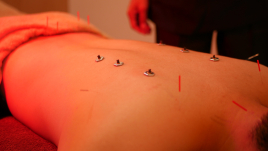 太田ウィル鍼灸マッサージ院 はり灸５０分コースのメニュー画像