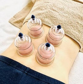 はり・きゅう整骨院　からださぽーと カッピング＋整体のメニュー画像