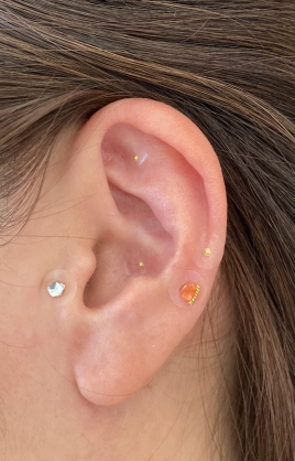 はり・きゅう整骨院　からださぽーと 耳つぼ（オプション）のメニュー画像