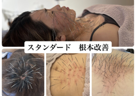 鍼処SHIRAKAWA京都院《ルート治療専門院》烏丸線北大路駅 スタンダード 根本改善 ルート治療のメニュー画像