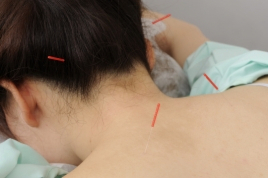 鍼灸院爽快館西葛西店 誠心堂式 三焦調整法 （子宝）のメニュー画像