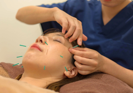 からだ接骨院 西神南院 人気No.2★《美容鍼》たるみやしわ◎のメニュー画像