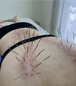 鍼処FUJINUMA 東京院 ルート治療　45分　期間限定特別価格📣のメニュー画像