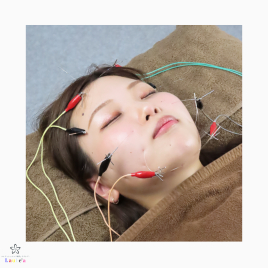 コンディショニング鍼灸Laule'a ~ラウレア~ 美容鍼 ~スタンダード~のメニュー画像