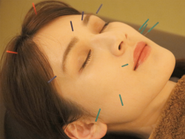 だいちの鍼灸院 美容鍼のメニュー画像
