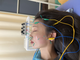 お灸の里鍼灸院 プレミアム美容鍼のメニュー画像