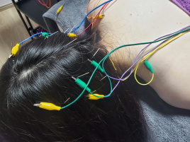 美容鍼《鍼灸VOIR  〜Ogaki〜》 頭部鍼のメニュー画像