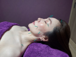 美容鍼《鍼灸VOIR  〜Ogaki〜》 美容鍼のメニュー画像