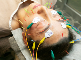 Simba鍼灸接骨院 【初回限定】美容鍼×頭皮鍼のコースのメニュー画像