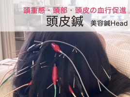 新駒鍼灸院 美容鍼 Head ~ 頭部・頭皮集中ケアのメニュー画像