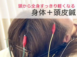 新駒鍼灸院 身体の鍼灸 + 美容鍼 Headのメニュー画像