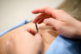 SUNplus等々力鍼灸院 鍼灸＆マッサージ45分のメニュー画像