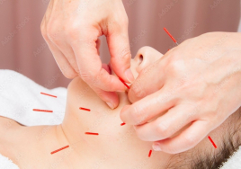 鍼灸ルーム　こころほっと治療院 鍼灸美容（オプション）コースのメニュー画像