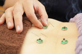 大きな森の鍼灸整骨院　城野駅院 鍼灸ポイントコースのメニュー画像