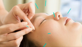 あい鍼灸院・接骨院 イオンタウン名取院 【美容鍼灸】のメニュー画像