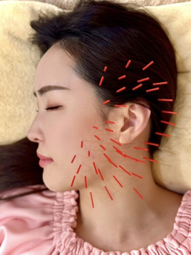 グラン治療院東京 くいしばり改善コースのメニュー画像