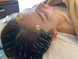 鍼灸サロン　la mer 頭痛・肩こり鍼灸（オイルリンパ付）のメニュー画像