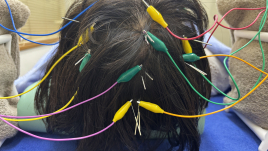 はりきゅうパンダ 頭の電気鍼（初回・初診料込）のメニュー画像