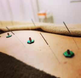 緑が丘はり灸治療院 【再来】はり施術のメニュー画像