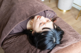 美容鍼灸 Salon Q Sapporo 手軽に受けられるシンプル美容鍼のメニュー画像