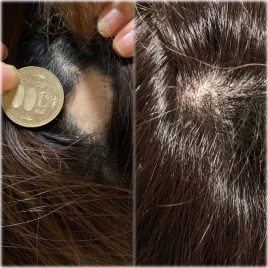 からほり　野の花堂　～１階　庵～ 美髪・育毛のはりのメニュー画像