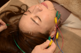 からほり　野の花堂　～１階　庵～ 美容鍼～ブンブンポイント～のメニュー画像