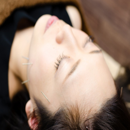 TOYBALANCE 美容鍼【トライアルコース】のメニュー画像