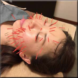 みゅう東京 お顔しっかりコースのメニュー画像