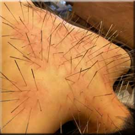 みゅう東京 ルート治療60分のメニュー画像