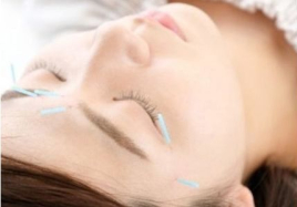 向山治療院 美顔鍼のみ　のメニュー画像