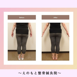 えのもと整骨鍼灸院 【整体】産後の骨盤矯正のメニュー画像