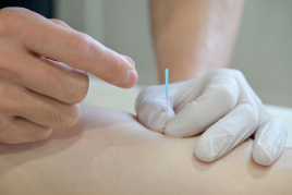 alpha（アルファ）鍼灸院 鍼灸×鍼灸のメニュー画像