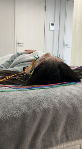 alpha（アルファ）鍼灸院 美容鍼オプションフェイスライン引き締め鍼のメニュー画像