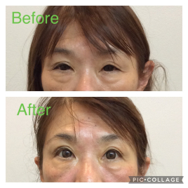 ワイズ宜野湾整骨院はりきゅう 美容鍼のメニュー画像