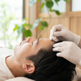 ひごころ治療院 頭皮環境を整える育毛鍼灸【全身調整付き】のメニュー画像