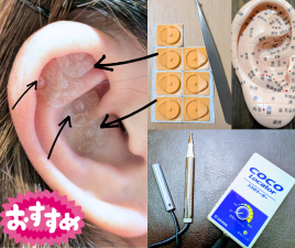 ゆず鍼灸治療院 耳つぼ鍼のメニュー画像