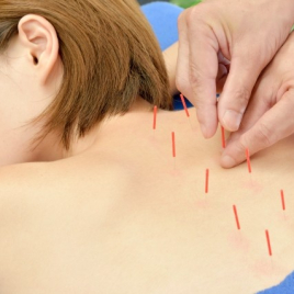 癒しの森指圧鍼灸院 鍼灸×指圧 全身調整フルコースのメニュー画像