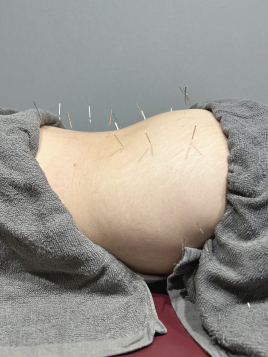 至福の空間　まごのて 鍼灸治療のメニュー画像