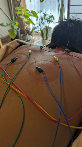 伊藤鍼灸院 PeaceHealing プレミアムコースのメニュー画像